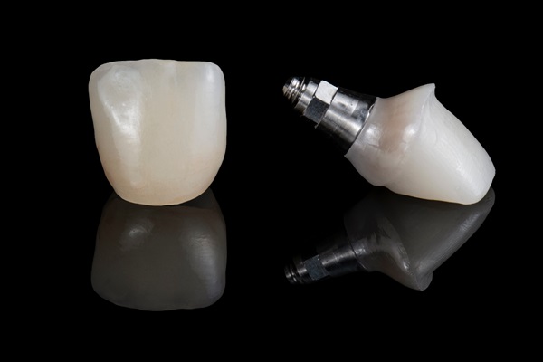 How Easy Is It To Replace An Implant Crown?